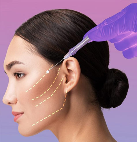 لیفت صورت، ابرو و رفع چین و چروک صورت و دور چشم