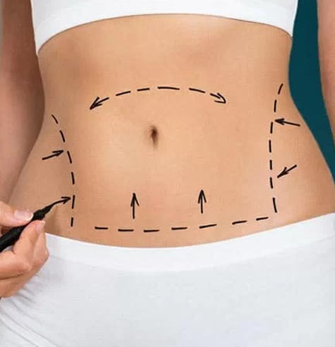 مزوی شکم جهت لاغری و کاهش سایز شکم و کم کردن اشتها